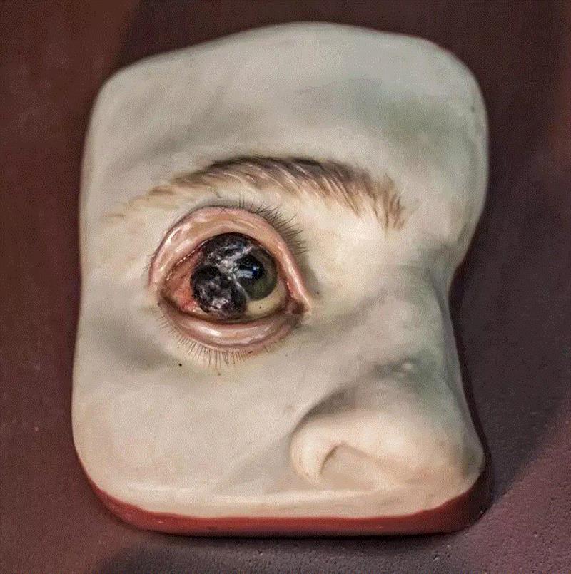 穆特博物馆馆藏的一套看起来非常痛苦的眼部蜡制模型（1882年购自巴黎梅森特拉蒙德公司）。它们其实是一