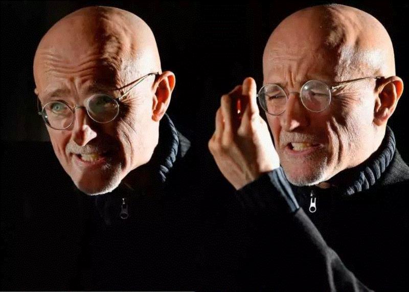 换头狂人卡纳韦洛,卡纳,韦洛,狂人,斯皮里多诺夫,头颅,医生,头部,脊髓,脑袋,躯体