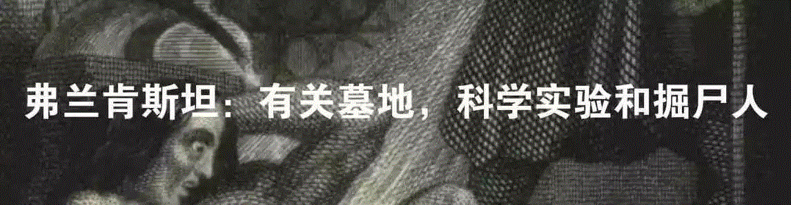 换头狂人卡纳韦洛,卡纳,韦洛,狂人,斯皮里多诺夫,头颅,医生,头部,脊髓,脑袋,躯体