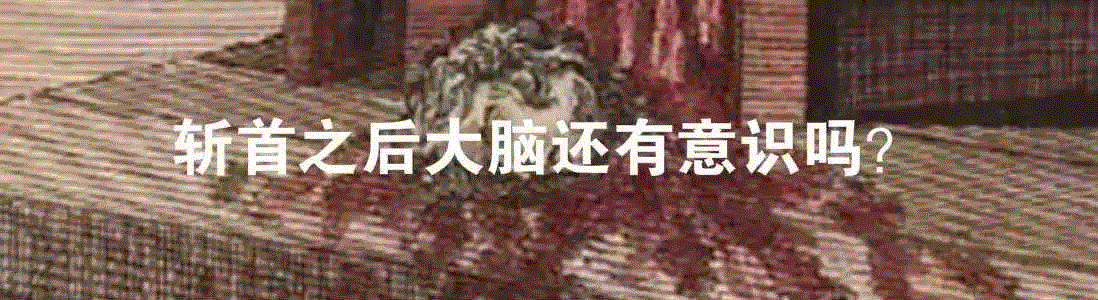 换头狂人卡纳韦洛,卡纳,韦洛,狂人,斯皮里多诺夫,头颅,医生,头部,脊髓,脑袋,躯体