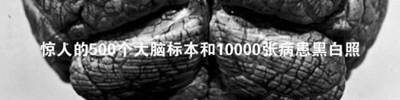 一个清朝人笔下的畸形人间,画像,肿瘤,关乔昌,帕克,图源,医院,病人,肖像,拉赫曼,传教士