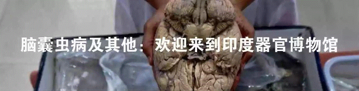 一个清朝人笔下的畸形人间,画像,肿瘤,关乔昌,帕克,图源,医院,病人,肖像,拉赫曼,传教士