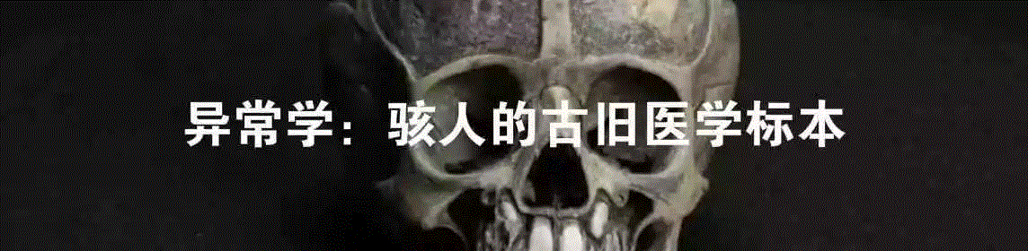 一个清朝人笔下的畸形人间,画像,肿瘤,关乔昌,帕克,图源,医院,病人,肖像,拉赫曼,传教士