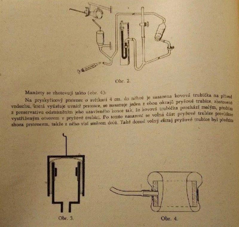 弗恩特一系列实验的首篇论文，《男性同性恋的诊断》，发表于1957年的捷克斯洛伐克精神病学期刊，文中出
