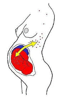 图源：Wikipedia,不止男女：是时候重新定义性别了,男女,基因,男性,女性,DSD,性腺,染色体,图源,睾丸,卵巢