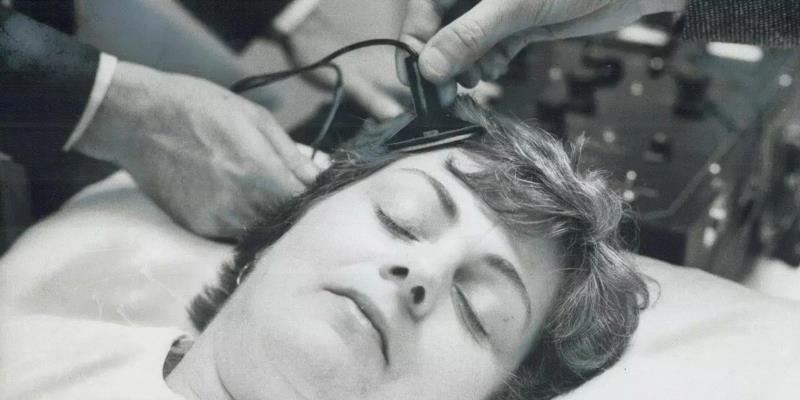 在1976年的一次电痉挛治疗中，多伦多一家医院的医生把机器的电极放在患者的头上。图源：Getty I