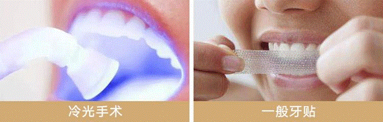 几十年小黄牙，贴它就白了