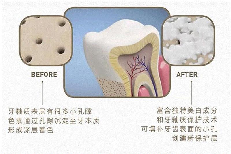 ▲&nbsp;羟基磷灰石成分是一种牙齿修复因子，可让牙齿更加坚固。,几十年小黄牙，贴它就白了