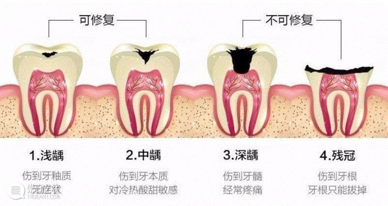一支牙釉质修护牙膏，能为你改变什么？