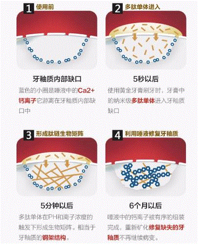 第1重保护：氟化亚锡去除牙齿颈部的敏感，这是消除牙敏感的最有效方法之一。,一支牙釉质修护牙膏，能为你改变什么？