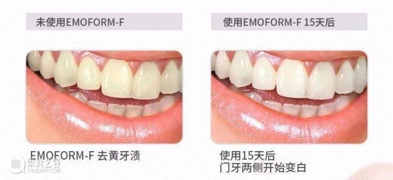 一支牙釉质修护牙膏，能为你改变什么？
