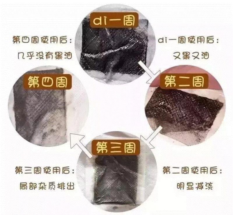 5块钱就能在家做一次泰式足底马杀鸡！逼出体内一年的湿气、寒气！比拔火罐还管用！,湿气,寒气,火罐,泰国,足贴,护理,PRINCESS,毒素,穴位,皇家