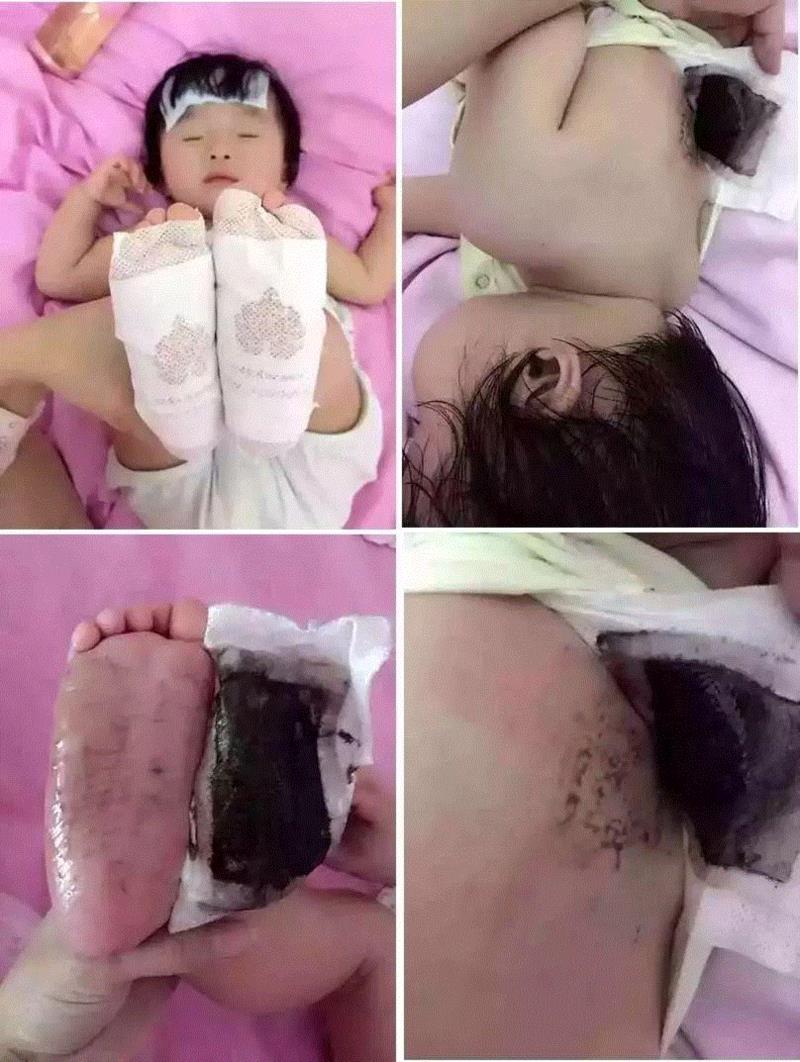 5块钱就能在家做一次泰式足底马杀鸡！逼出体内一年的湿气、寒气！比拔火罐还管用！,湿气,寒气,火罐,泰国,足贴,护理,PRINCESS,毒素,穴位,皇家