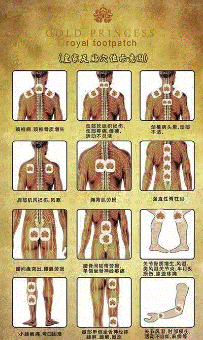 5块钱就能在家做一次泰式足底马杀鸡！逼出体内一年的湿气、寒气！比拔火罐还管用！,湿气,寒气,火罐,泰国,足贴,护理,PRINCESS,毒素,穴位,皇家