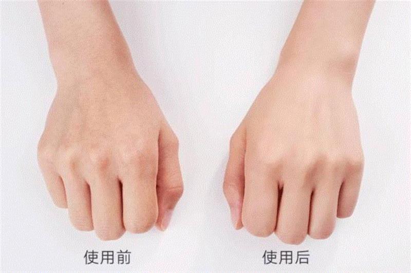 糙手救星，连干裂冻疮和老茧都能修复,修复,老茧,救星,干裂,冻疮,双手,皮肤,肌肤,保养,脱皮