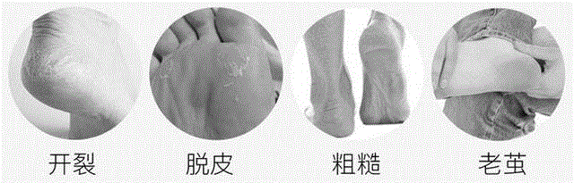 糙手救星,连干裂冻疮和老茧都能修复,修复,老茧,救星,干裂,冻疮,双手,皮肤,肌肤,保养,脱皮