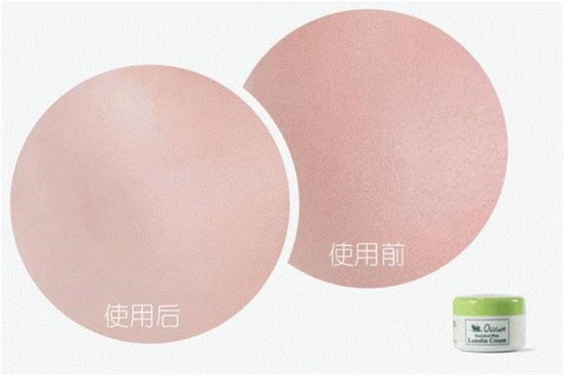 90岁英女王保养得像60岁，原来也爱用它护肤,英女王,保养,皮肤,绵羊,羊油,澳洲,肌肤,绵羊油,毛孔,精华