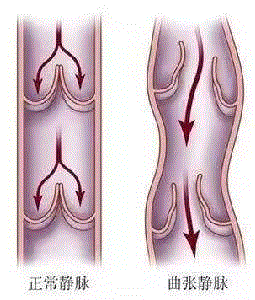这款日本美腿塑形打底裤是1000万女性共同的选择，让你轻松告别腿部臃肿！,腿部,日本,女性,袜子,静脉,连裤袜,小腿,分段,弹性,脂肪