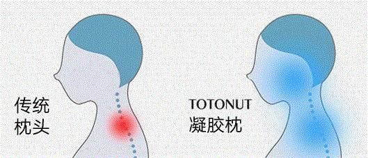 这个枕头是有多舒服？一夜无梦，醒来神清气爽,枕头,睡眠,记忆,TOTONUT,颈椎,凝胶,凝胶枕,冠军,暖暖,物道