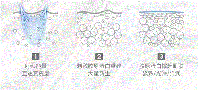 传说中能返老还童的“童颜机”来了!,传说,童颜机,美容,部位,磁头,美容仪,TriPollar,蛋白,皮肤,多极