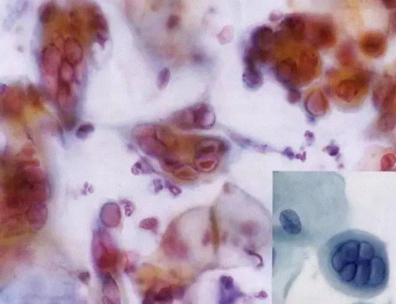 睡眠质量差？试试这些枕头和被子