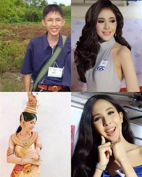 【惊奇】泰国人妖变性前后对比照,比女人还美!