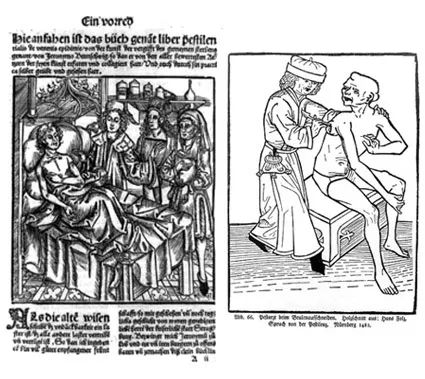 1 下面的版画作品显示了瘟疫中的病人正在接受治疗的画面。左边这幅作品来自Hieronymus Brunschwig，创作于1500年左右。右边的木版画来自15世纪的德国，医生正用手术刀处理病人身上瘟疫导致的伤口.jpeg