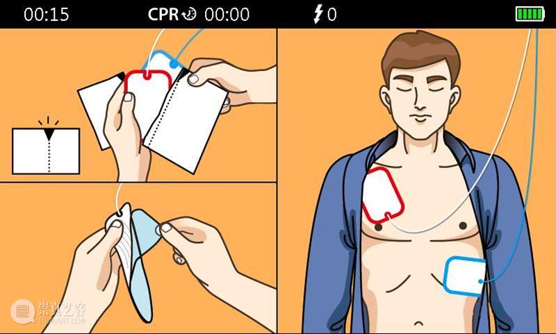 公益众筹｜猝死从来不分年龄，身边一台AED可挽救无数生命 AED 生命 公益 众筹 年龄 身边 睡眠 情绪 生活 作息 崇真艺客