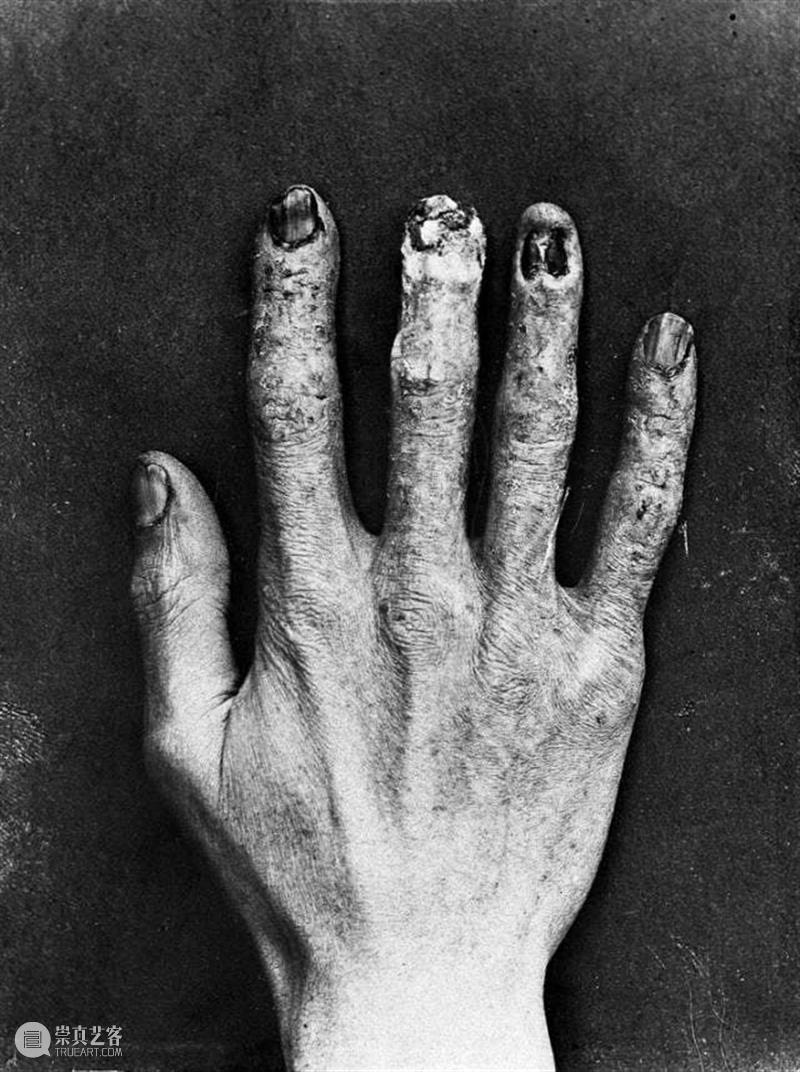 最诡谲的十件惠康博物馆藏品 惠康博物馆 藏品 利维坦 伦敦 医疗 历史 博物馆 惠康基金会 英籍 美国 崇真艺客