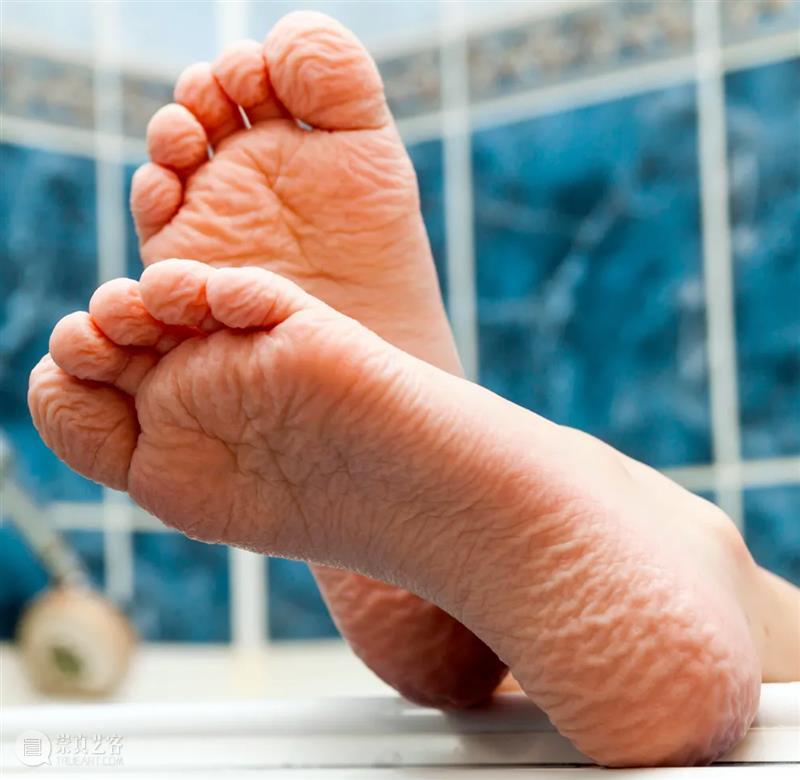 为何手指泡水会起皱？ 崇真艺客