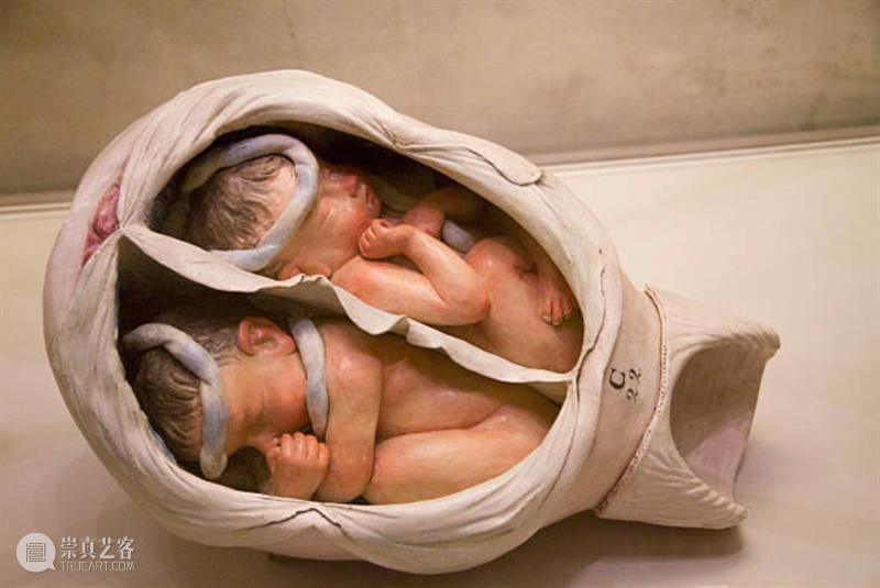 子宫、胎儿和宇宙：近代关于怀孕的诸多想象 崇真艺客