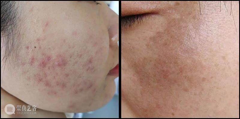 身体“负担”太重？每天一杯鸡内金山楂膏，堆积畅毒通通排出，肉眼显瘦一大圈！ 崇真艺客