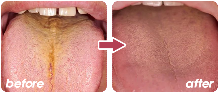 身体“负担”太重？每天一杯鸡内金山楂膏，堆积畅毒通通排出，肉眼显瘦一大圈！ 崇真艺客