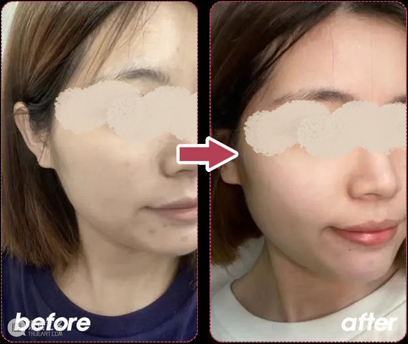 身体“负担”太重？每天一杯鸡内金山楂膏，堆积畅毒通通排出，肉眼显瘦一大圈！ 崇真艺客