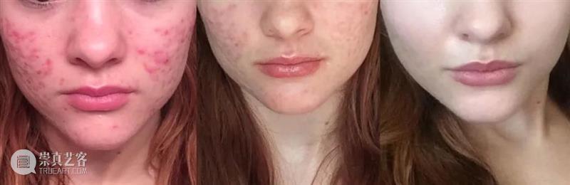 身体“负担”太重？每天一杯鸡内金山楂膏，堆积畅毒通通排出，肉眼显瘦一大圈！ 崇真艺客