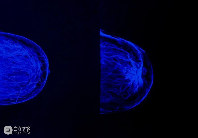 「女性艺术家访谈」周雯静：做一个对自己身体尚存感知的人 崇真艺客